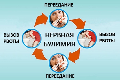 Лечение булимии в Красногорске